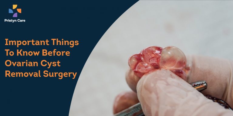 Things to know about ovarian cyst removal surgery