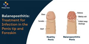 Balanoposthitis