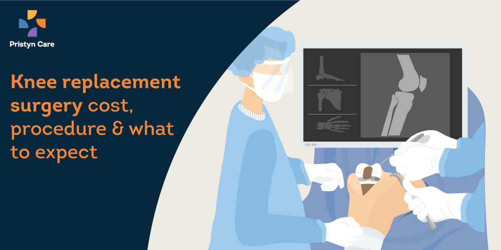 Knee replacement surgery cost, procedure and what to expect