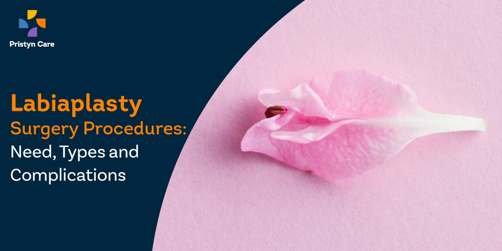 Labiaplasty-Surgery-Procedures-Need-Types-and-Complications