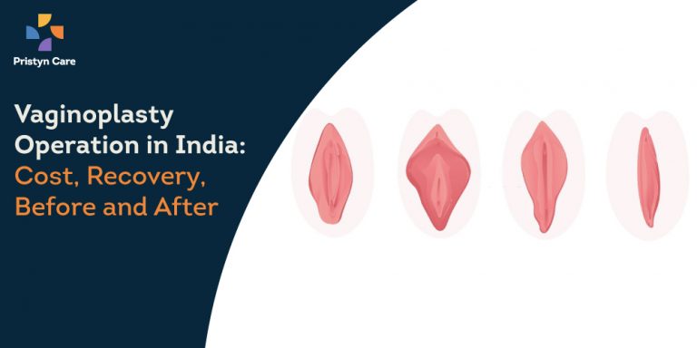 Vaginal Rejuvenation Cost