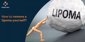 remove lipoma yourself