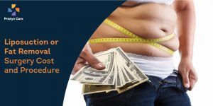 liposuction-cost-and-removal