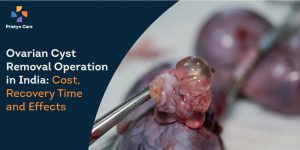 Ovarian Cyst Removal Operation in India