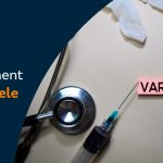 best-treatment-for-varicocele