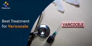 best-treatment-for-varicocele