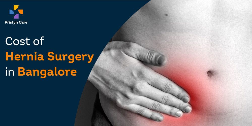 Cost of Hernia Surgery (Laparoscopic) in Bangalore