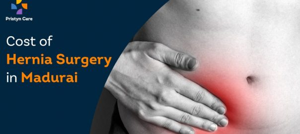 Cost of Hernia Surgery in Madurai