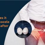 how-long-does-it-take-for-varicocele-to-disappear-after-surgery