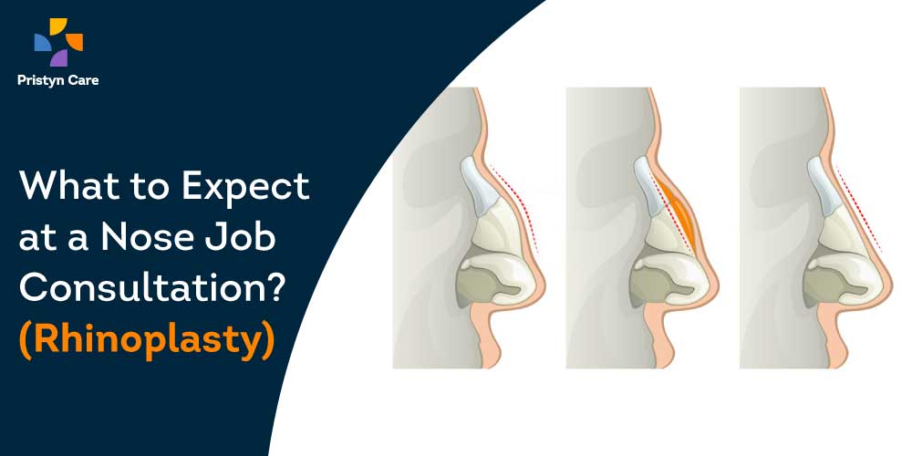 nose-job-consultation