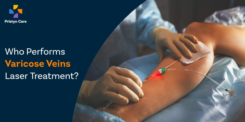 who-performs-varicose-veins-laser-treatment