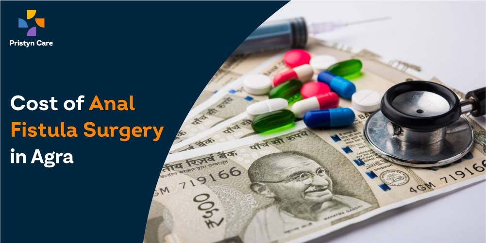 Cost of Anal Fistula Surgery in Agra