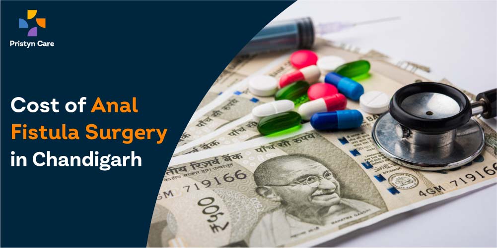 Cost of Anal Fistula Surgery in Chandigarh
