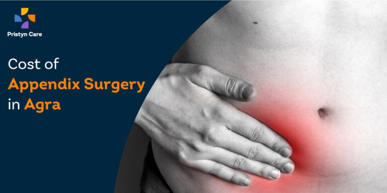Cost of Appendix (laparoscopic) Surgery in Agra