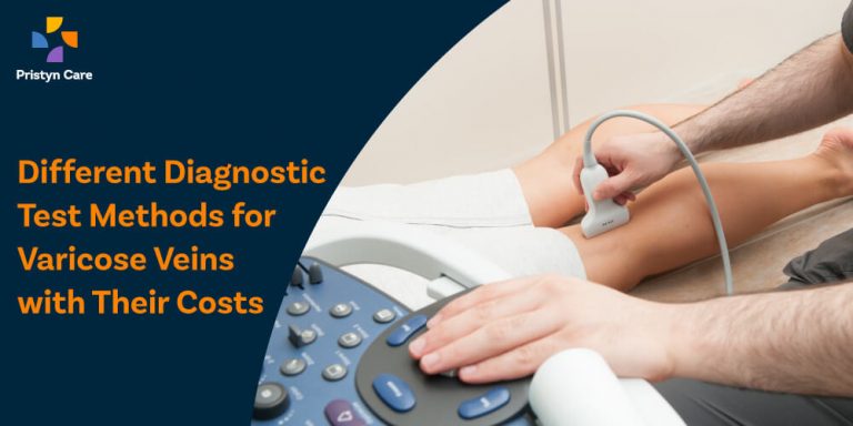 diagnostic-test-for-varicose-veins