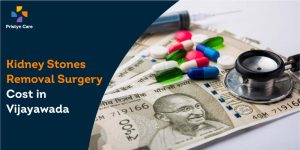 Kidney Stones Removal Surgery Cost in Vijayawada