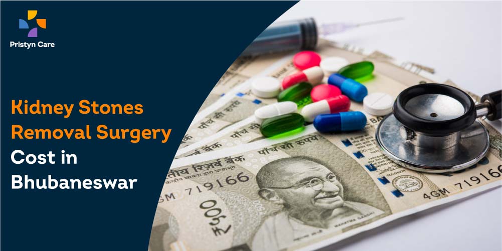 Kidney Stones Removal Surgery Cost in Bhubaneswar