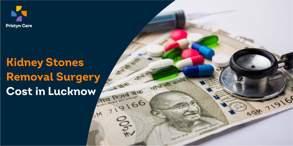 Kidney Stones Removal Surgery Cost in Lucknow