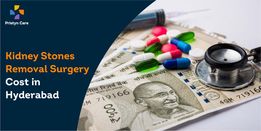 Kidney Stones Removal Surgery Cost in Hyderabad