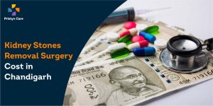 Kidney Stones Removal Surgery Cost in Chandigarh