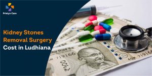 Kidney Stones Removal Surgery Cost in Ludhiana