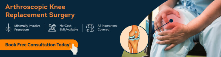 Knee Replacement Surgery banner