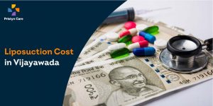 Liposuction Cost in Vijayawada