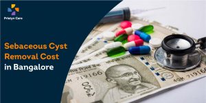 Sebaceous Cyst Removal Cost in Bangalore