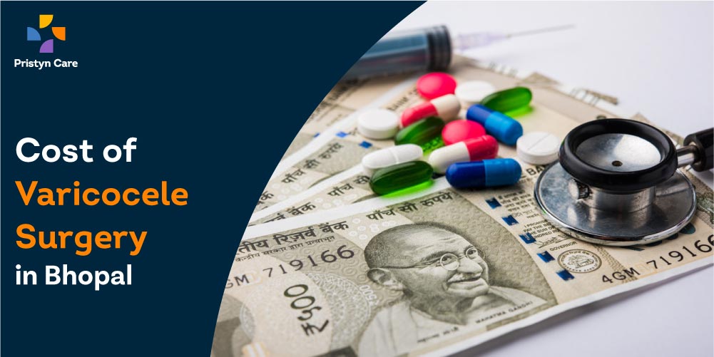 Cost of Varicocele Surgery in Bhopal