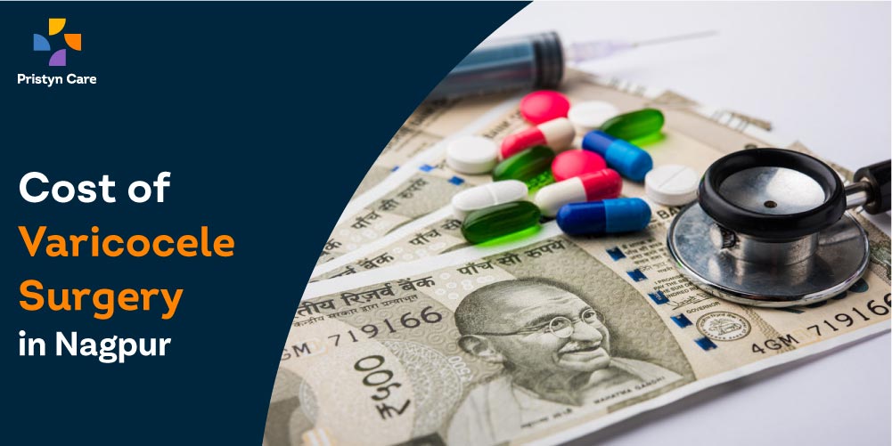 Cost of Varicocele Surgery in Nagpur