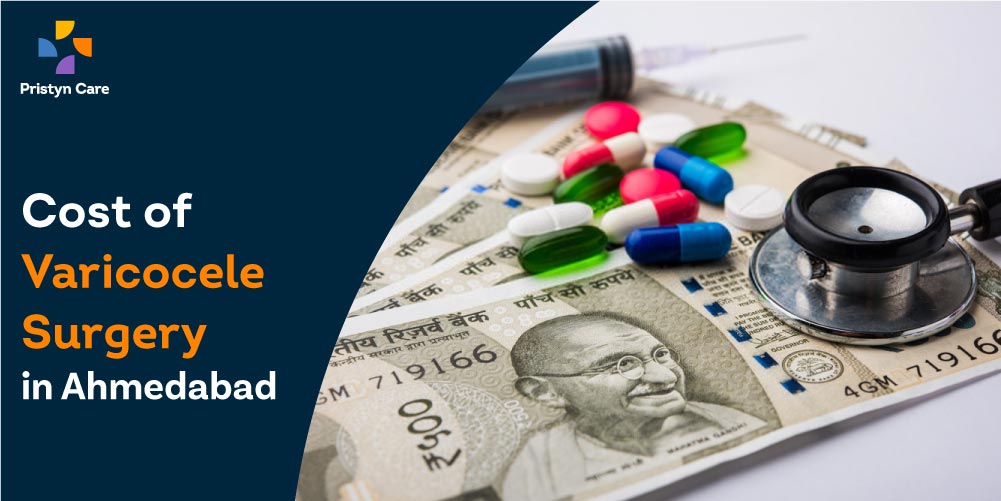 Cost of Varicocele Surgery in Ahmedabad