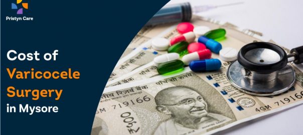 What is the cost of Varicocele Surgery in Mysore?