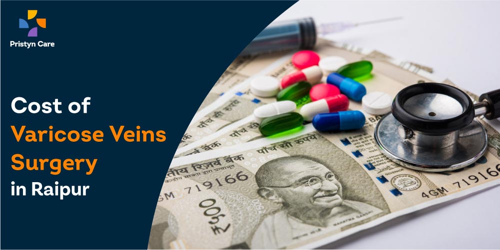 Varicose Veins Surgery Cost in Raipur - Pristyn Care Varicose Veins Surgery Cost in Raipur - Pristyn Care