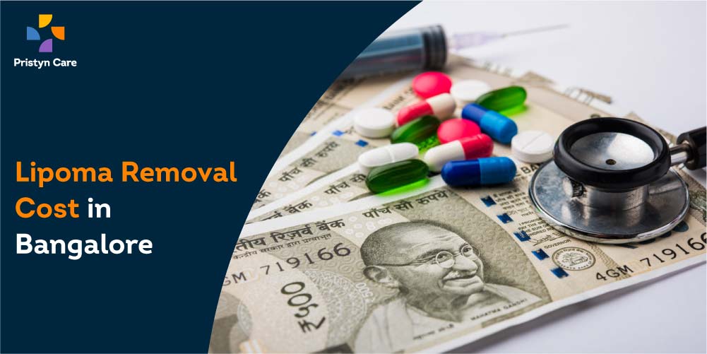 lipoma-cost-bangalore