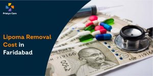 lipoma-cost-faridabad