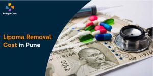 lipoma-cost-pune