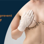Saggy Breast Treatment
