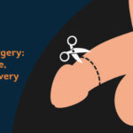 Phimosis Treatment through Laser Circumcision Surgery