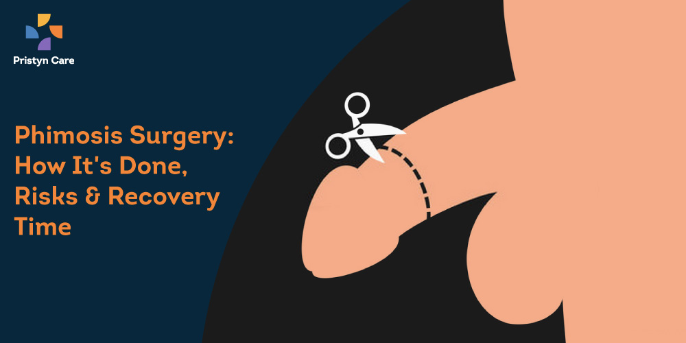Phimosis Treatment through Laser Circumcision Surgery