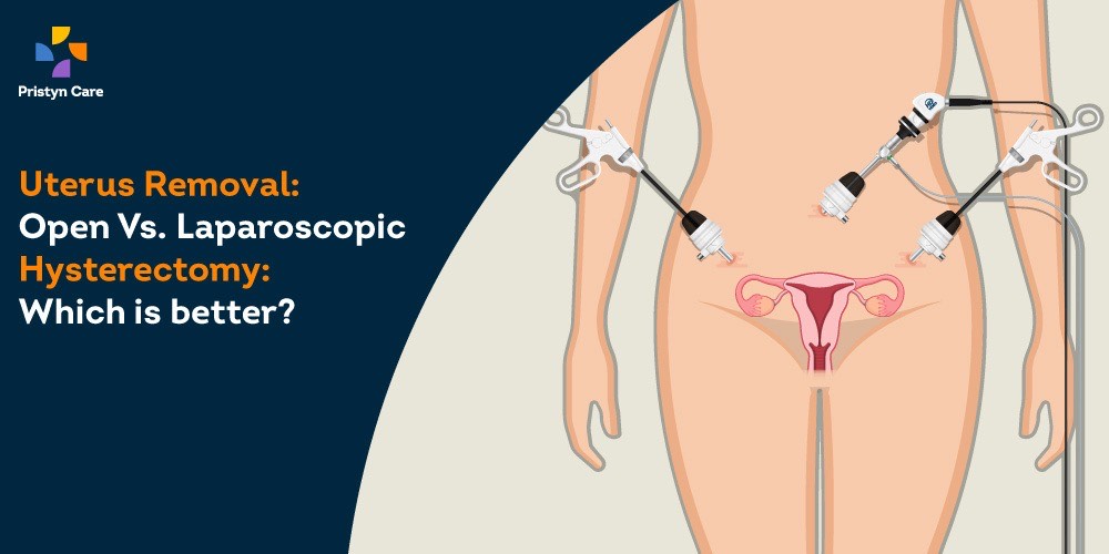 Open Vs. Laparoscopic Hysterectomy