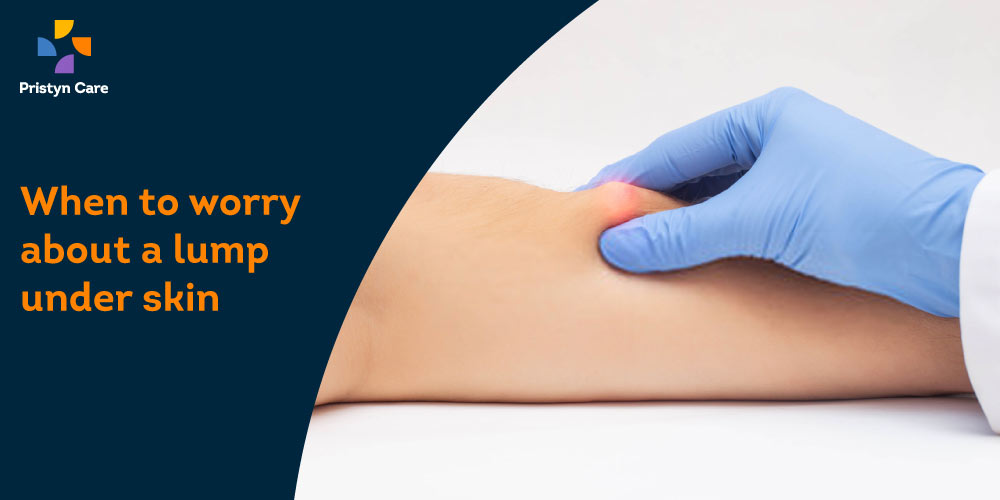 Who needs lipoma treatment?