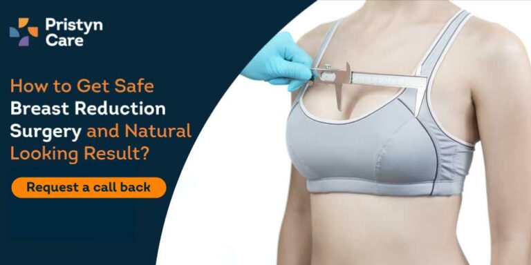 Breast-Reduction-Surgery