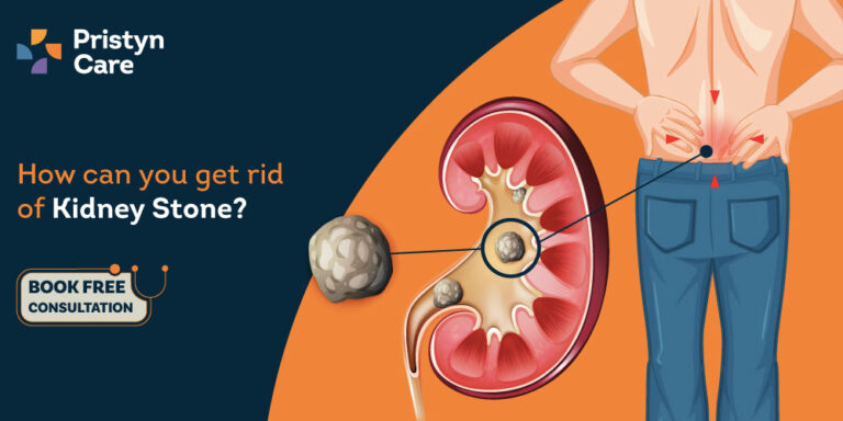How to get rid of kidney stones