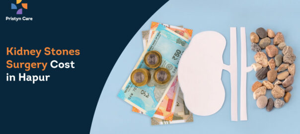 Kidney Stones Surgery Cost in Hapur
