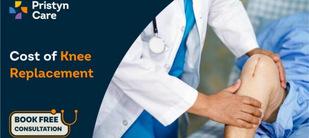 Cost of Knee Replacement in
