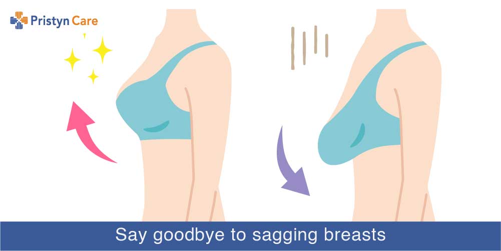 What is the best surgery for sagging breasts and it's cost in DelhiNCR? Pristyn Care