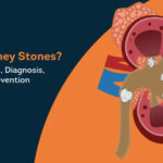 kidney stones : causes, symptoms, diagnosis, treatment & prevention
