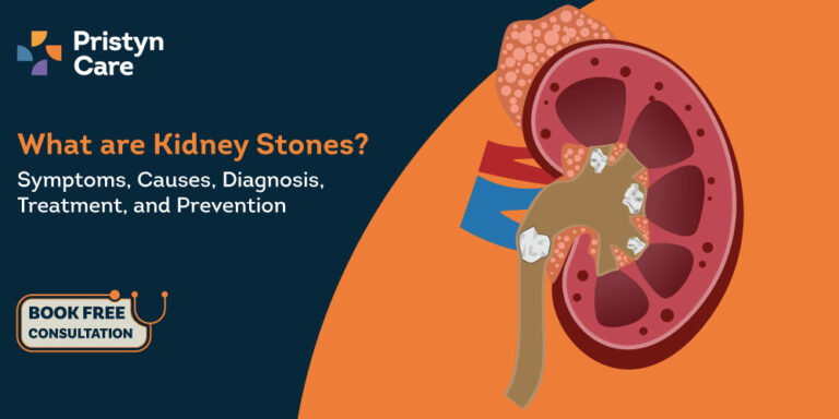 kidney stones : causes, symptoms, diagnosis, treatment & prevention