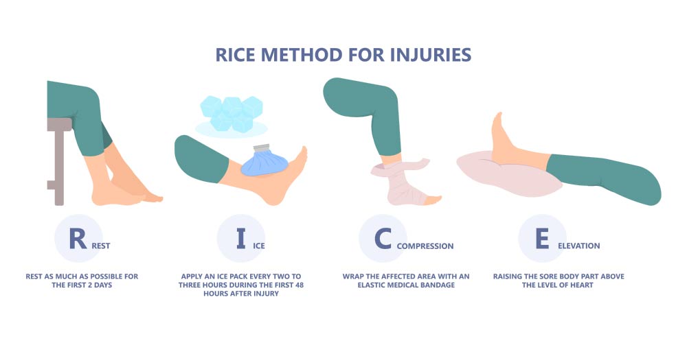 Rice Method For Injuries