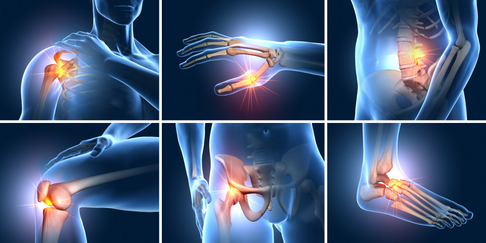 set of six painful joints